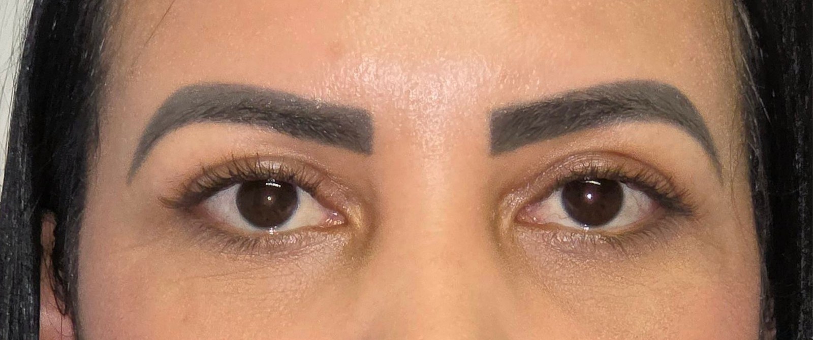 Caso 2 — depois